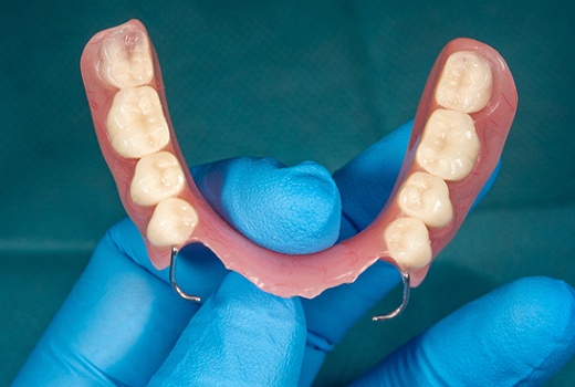 a dentist holding partial dentures