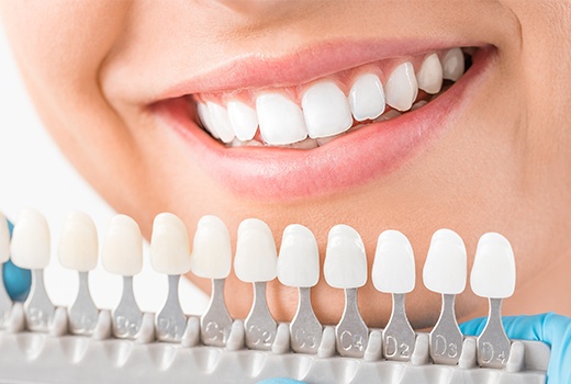 Invisalign