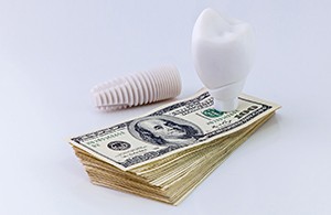 Dental implant on stack of cash