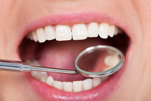 Teeth examined with dental mirror
