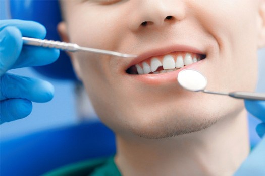 A man with a broken tooth