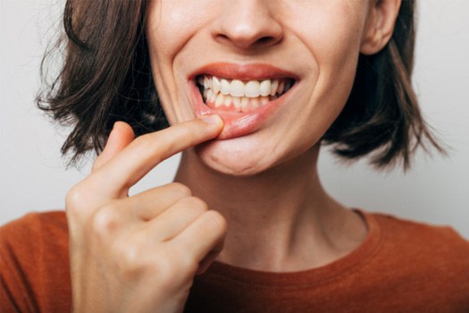 A woman with bleeding gums