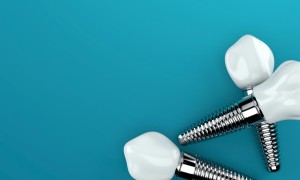 Dental implants in Lynchburg are the best tooth replacement option.
