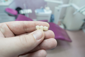 Close-up of hand holding a dental bridge