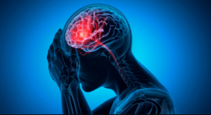 Illustration showing brain of a person about to have a stroke
